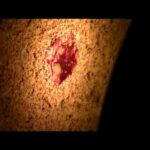 Thumbnail of related posts 152